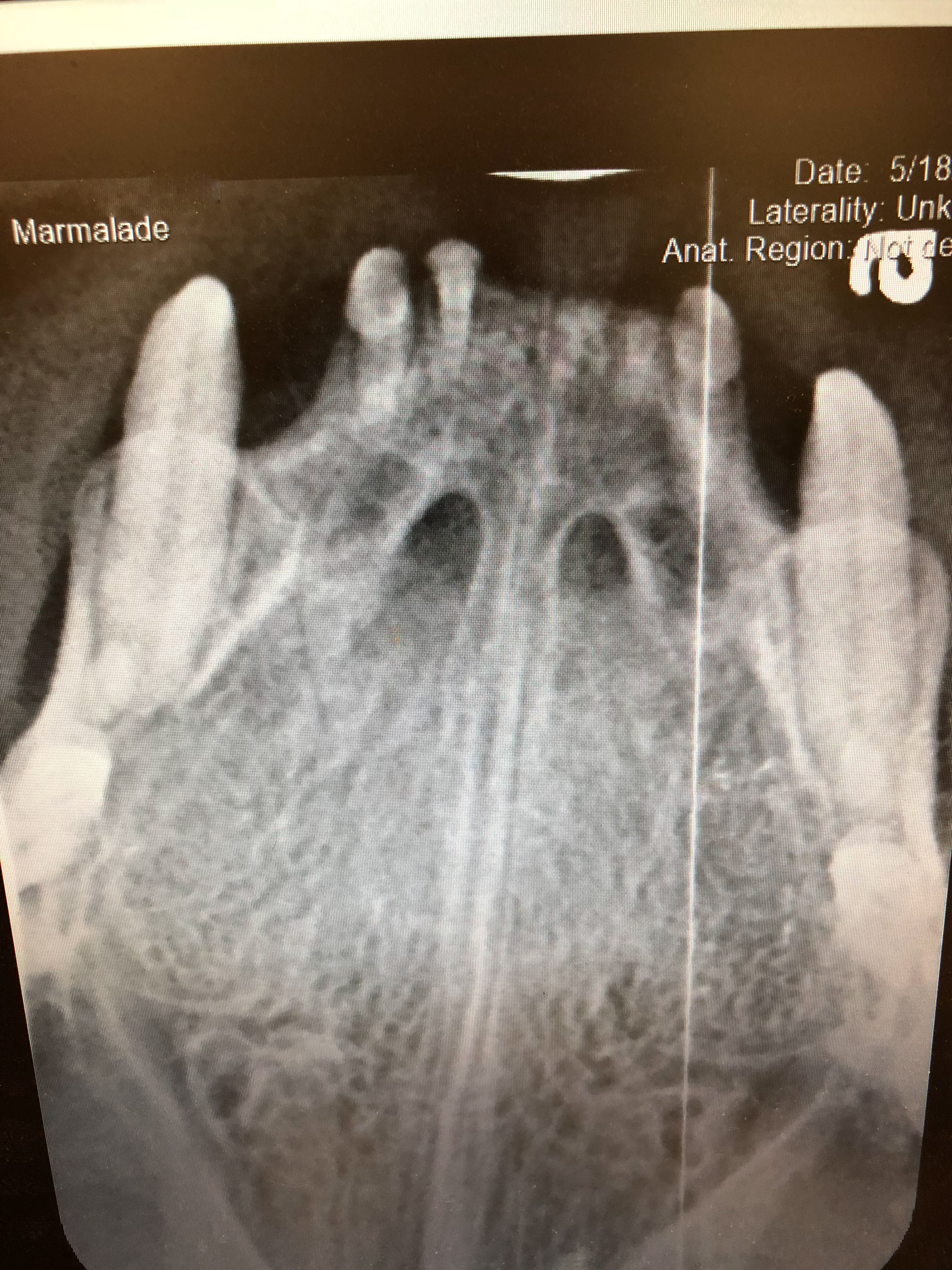 Marmalade's Dental X-rays